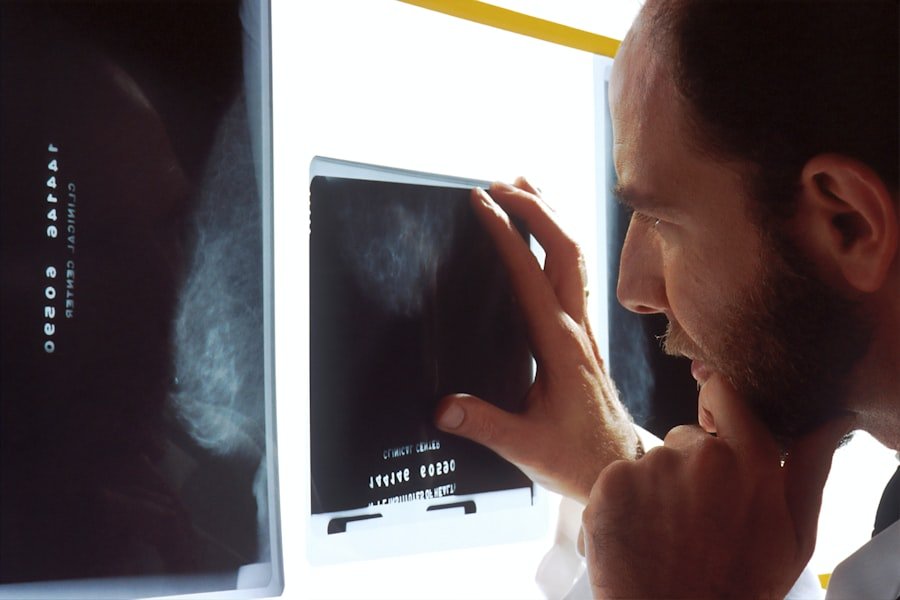 xray
