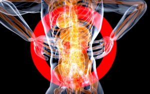 Read more about the article When Back Pain Becomes Sciatica: Signs It May Be a Nerve Problem