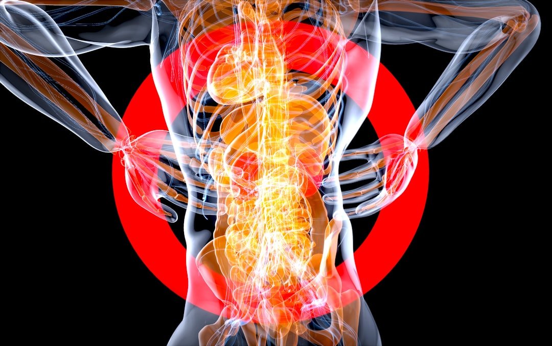 Read more about the article When Back Pain Becomes Sciatica: Signs It May Be a Nerve Problem