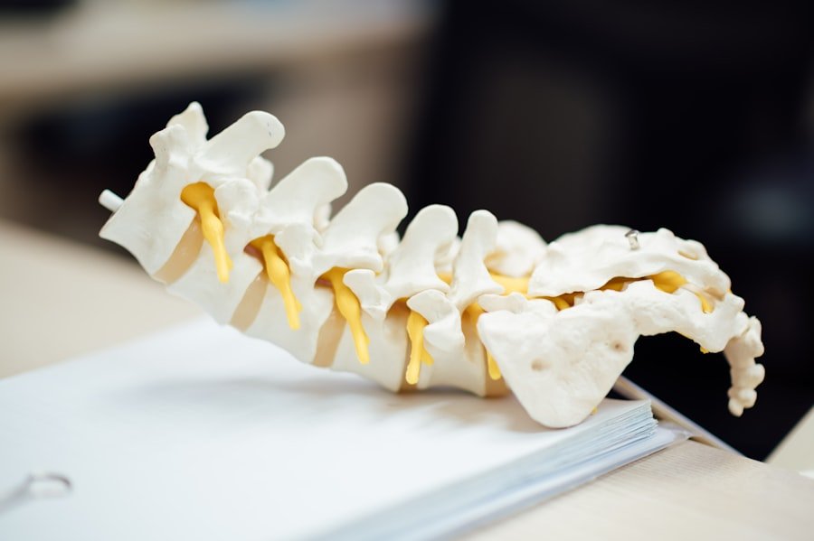 Photo Spine Surgery