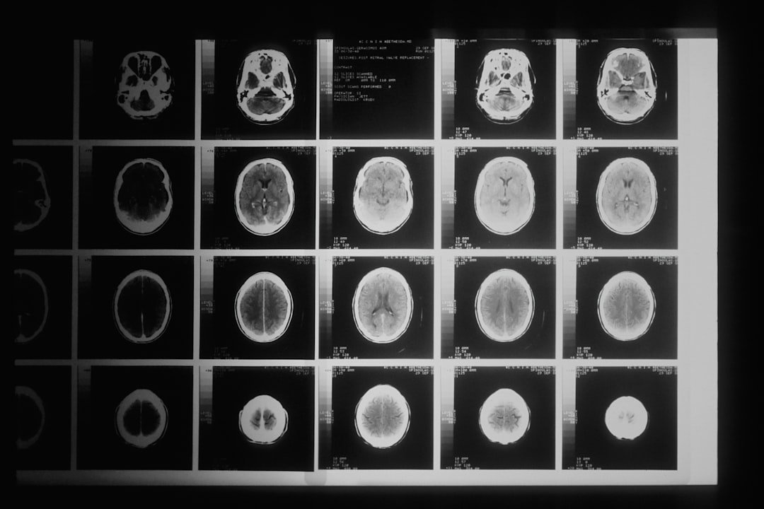 You are currently viewing When Is a Free MRI Review Worth Getting for Back or Neck Pain?